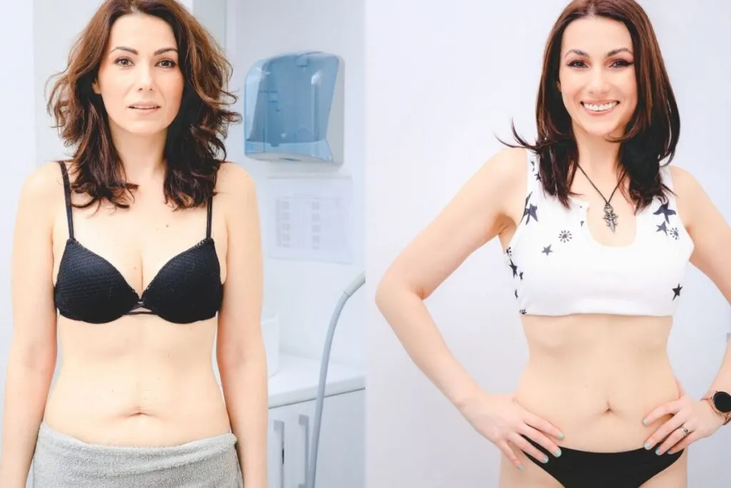 navi - accent prime Before After